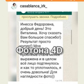 Fotona 4D омоложение в Иркутске