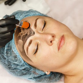 Карбоновый пилинг