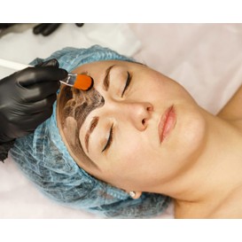 Карбоновый пилинг