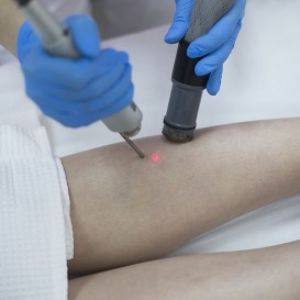 Лазерное удаление сосудов