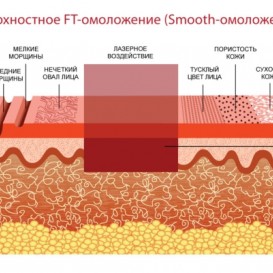 Экспресс-омоложение