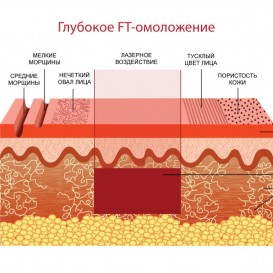 Глубокое дермальное омоложение