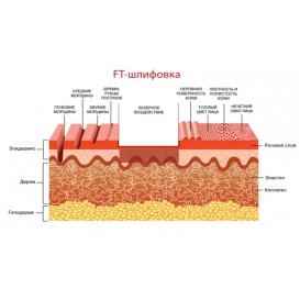 Лазерная шлифовка
